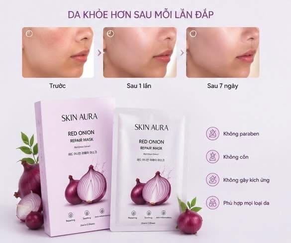 MẶT NẠ HÀNH TÍM GIẢI PHÁP CHO LÀN DA THÂM MỤN THIẾU SỨC SỐNG - Ảnh 2